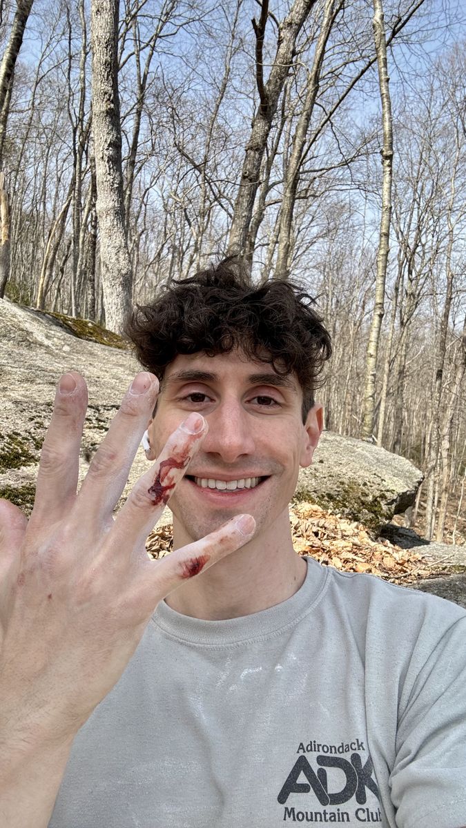 Anthony grinning at the camera after a climb, chalky fingers scraped up